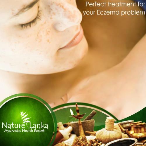 Hotel Nature Lanka Ayurveda Resort